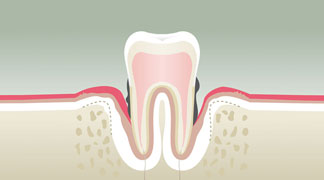parodontologie draveil